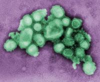 甲型H1N1流感
